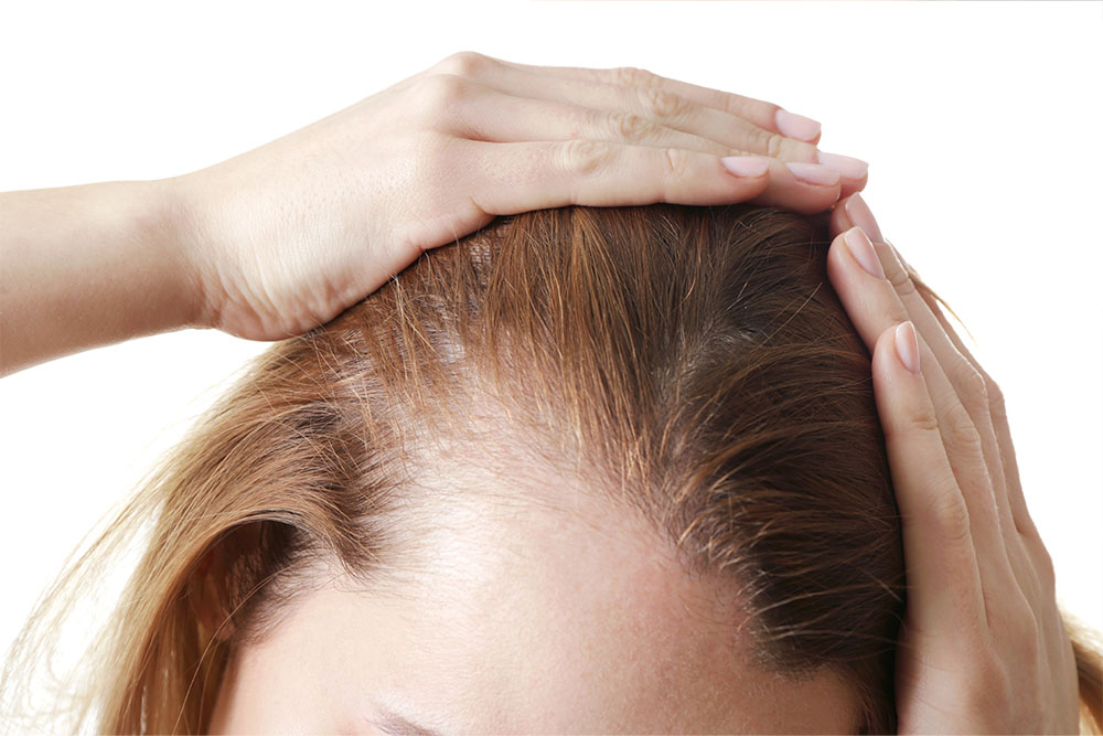 Obrazek wpisu: Wypadanie włosów – jak je powstrzymać?
